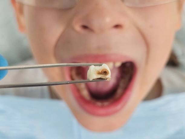 Best Emergency Denture Repair in Wedgefield, FL